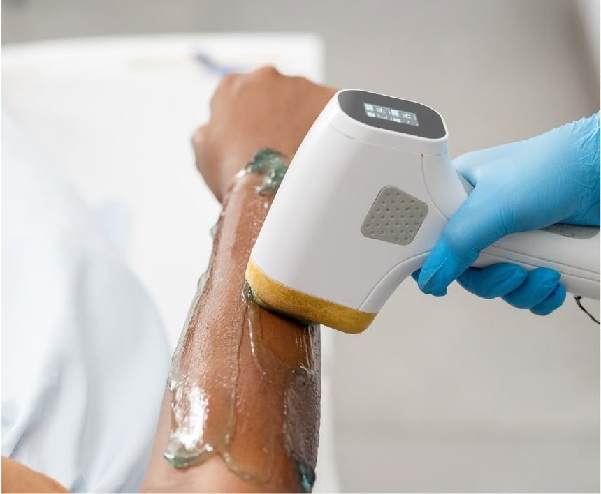 Services 1 LASER HAIR REMOVAL Services Silky Skin