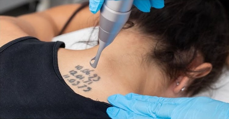 Services 5 TATTOO REMOVAL Services Silky Skin