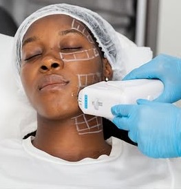 Services 4 HIFU (High-Intensity Focused Ultrasound) Services Silky Skin