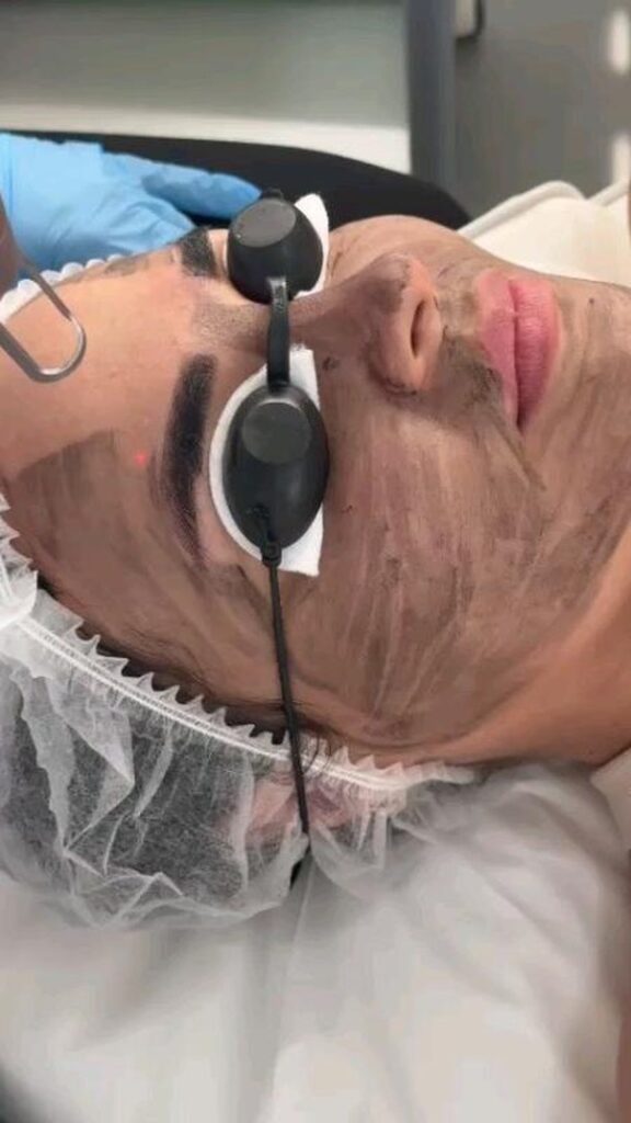 Services 2 CARBON LASER TREATMENTS Services Silky Skin
